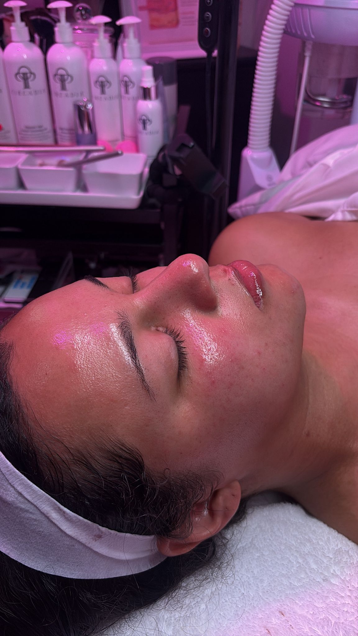 Acne treatment in Overland Park